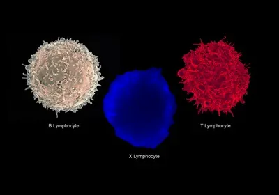 dual expresser t cell immunology type 1 diabetes